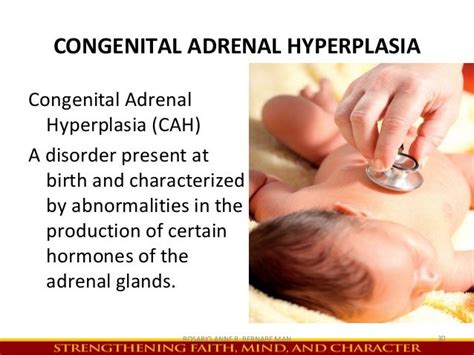 Congenital Adrenal Hyperplasia Newborn