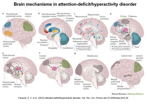 Eight Pictures Describe Brain Mechanisms in ADHD | APSARD