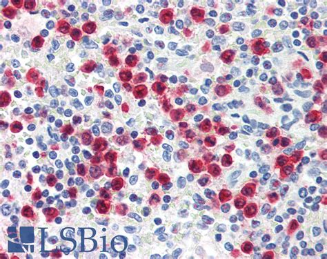 IHC Plus S100A8 MRP8 Monoclonal Antibody Mouse Anti Human LSBio