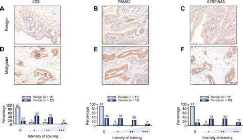 Whole Genome Rna Expression Profiling Of Endoscopic Biliary Brushings