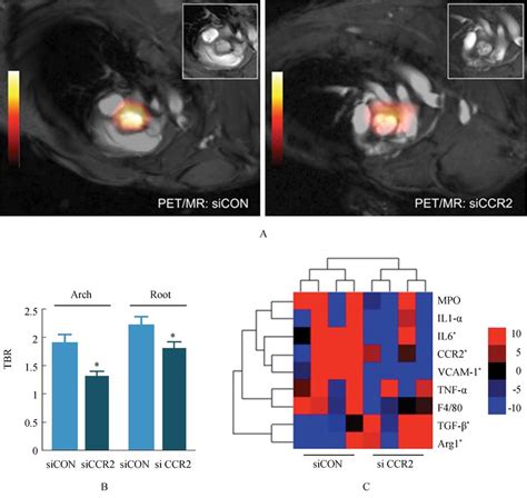 Positron Emission Tomography Magnetic Resonance Image PET MRI And