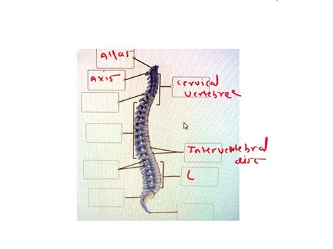 Solved Label The Structures Of The Vertebral Column Vertebral