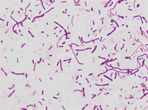 Ornithobacterium rhinotracheale - Alchetron, the free social encyclopedia