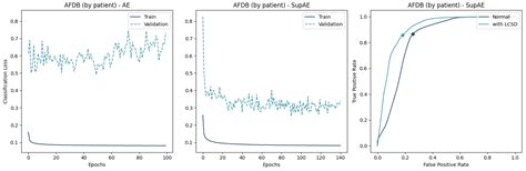 Sensors Free Full Text Morphological Autoencoders For Beat By Beat Atrial Fibrillation