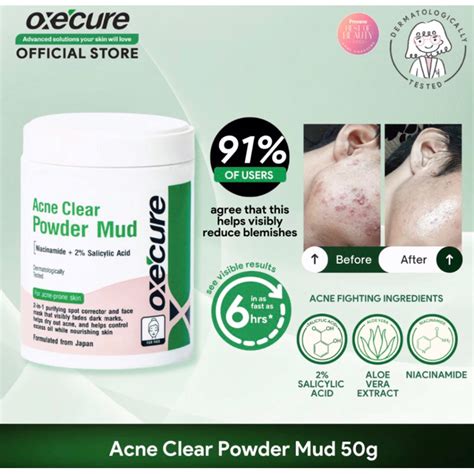 Oxecure Acne Clear Powder Mud 50g Authentic Expiry Oct2025 Shopee Philippines