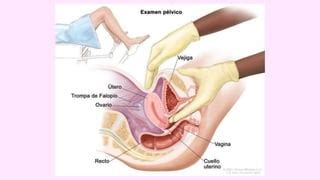 Tacto Vaginal Pptx