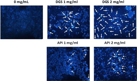 DAPI staining microscopy of HT-29 cells treated for 24 h with different ...