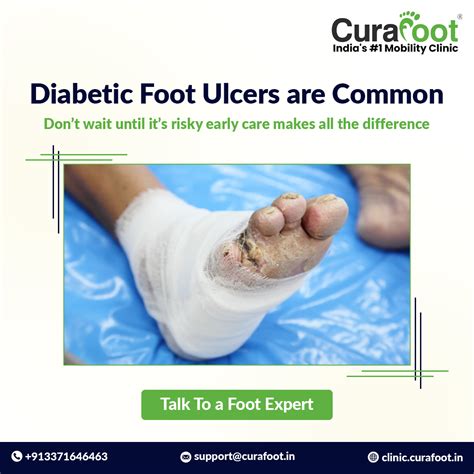 CuraFoot - Prevent Diabetic Foot Ulcers with Early Intervention!👣 Did ...