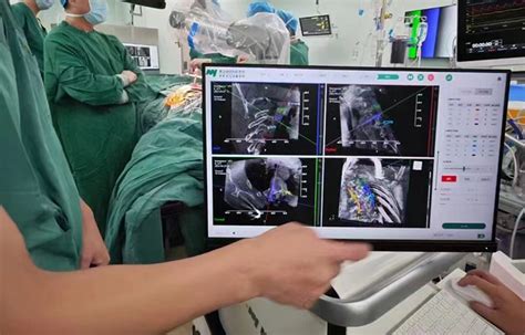 Meyer Spinal Surgery Robot HEFEI MEYER OPTOELECTRONIC TECHNOLOGY INC