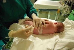 Experiences with Inguinal Hernia - Baby Hints and Tips