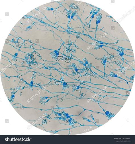 Penicillium Under Microscope 400x