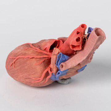 Heart and the Distal Trachea (carina and primary bronchi) – Veresk Tajhiz