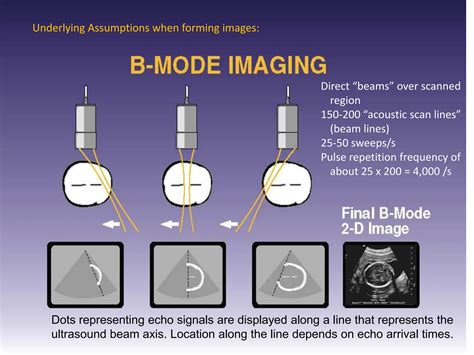 Reverberation Artifacts in ultrasound imaging | PPT