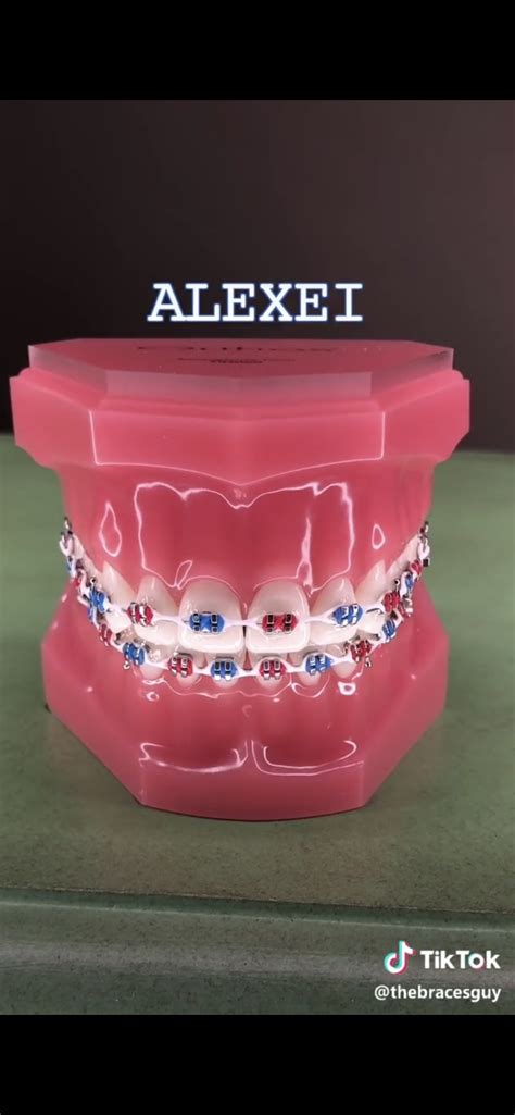 Got This From Thebracesguy On Tiktok Braces Colors Dental Braces