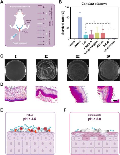 A Probiotic Nanozyme Hydrogel Regulates Vaginal Microenvironment For