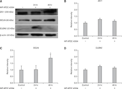 Expression Of Zonula Occludens 1 Zo 1 Occludin Ocln And Claudin 2