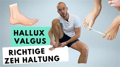 Hallux Valgus Wegtrainierten Einfache Bungen Youtube