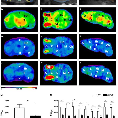 18F FDG Uptake In 7 Month Old Female 5XFAD Mice And Age And