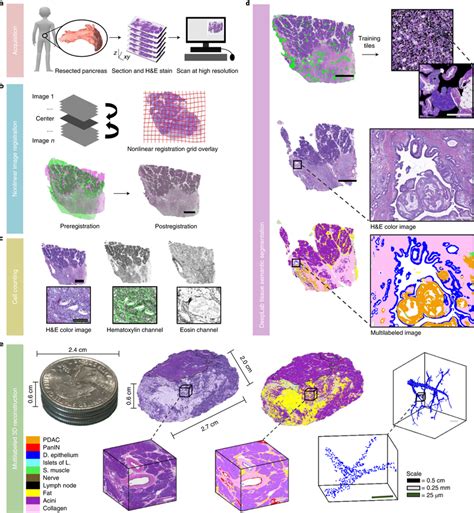 Coda A Human Pancreatic Tissue Was Serially Sectioned Stained And