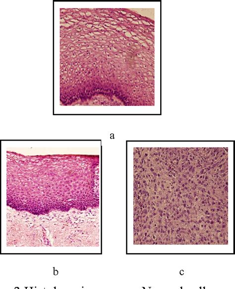 Classification Cervical Cancer Using Histology Images | Semantic Scholar