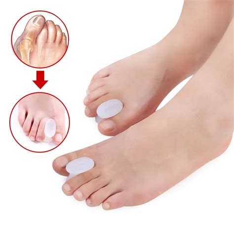 2Pair Silicone Bunion Toe Separator Finger Toe Outer Appliance Hallux