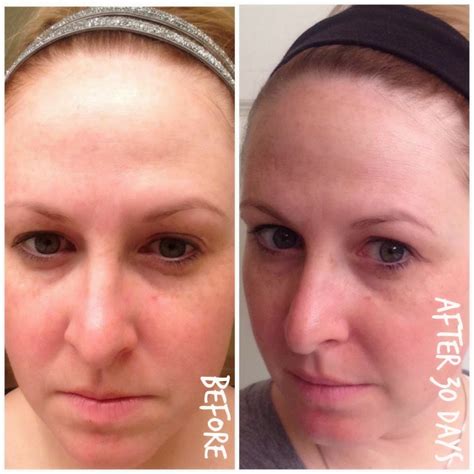 Nerium Night And Day Cream Review