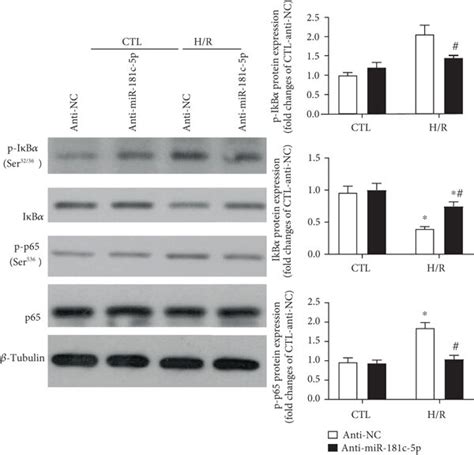 Inhibition Of Mir 181c 5p Suppressed Nfκb Mediated Inflammation In H9c2