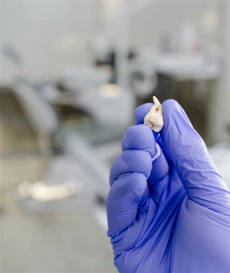 Expert Care For Complex Tooth Extractions Your Guide Bücco