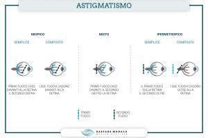 Astigmatismo Miopico Sintomi Tipologie Cause E Correzione