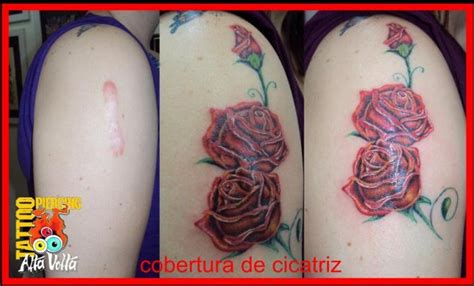 Cobertura Cicatriz C QueloÍde Tatuagens Tattoo