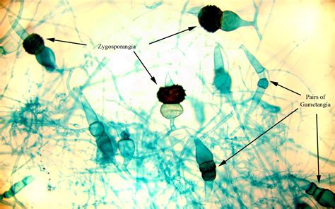 Zygosporangia Of Rhizopus Nigricans, 45% OFF