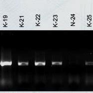 Agrobacterium Based Rice Transformation Using Mature Embryos Of Rice