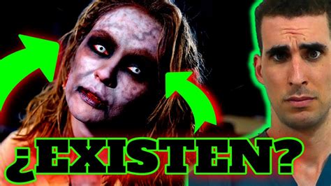 Zombies Existen Caso Real Una De Las Enfermedades M S Raras Del