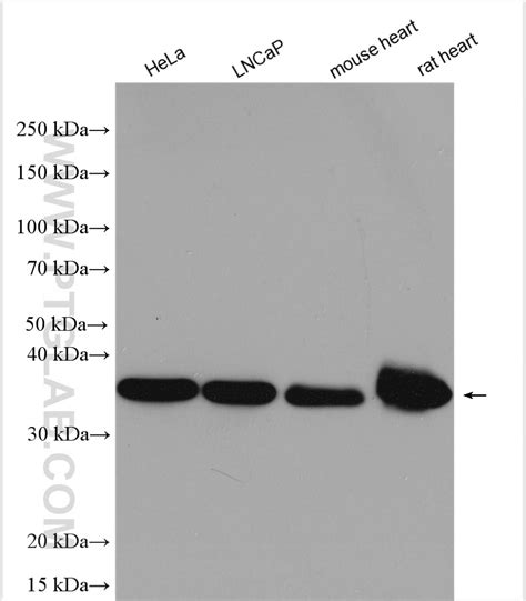 Ldhb Antibody 14824 1 Ap Proteintech 武汉三鹰生物技术有限公司