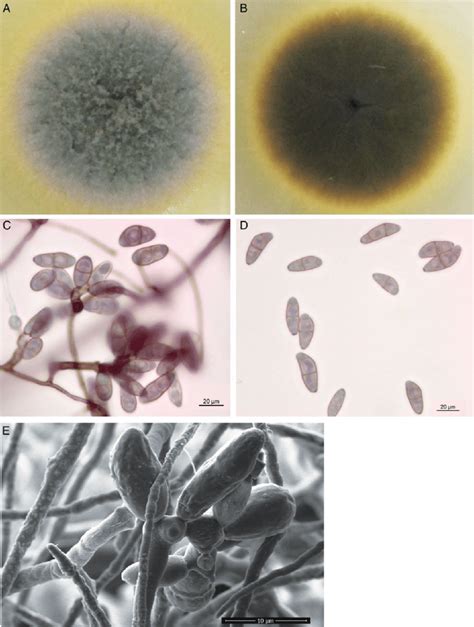 Colonial Characteristic And Microscopic Morphology Of Bipolaris