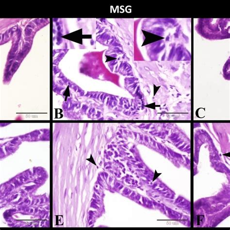 Photomicrograph Of Paraffin Sections In The Rats Seminal Vesicles