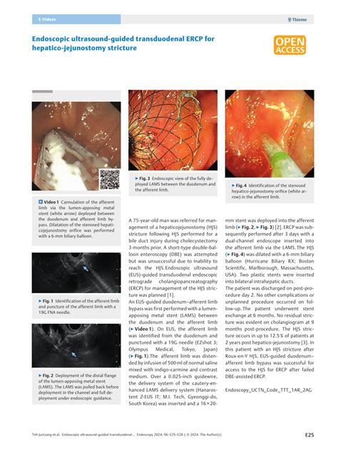 Pdf Endoscopic Ultrasound Guided Transduodenal Ercp For Hepatico