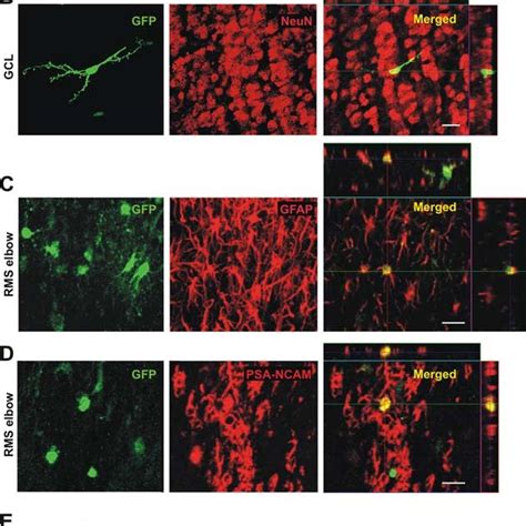 Identity Of Lentiviral Transduced Cells In The RMS A GFP Encoding