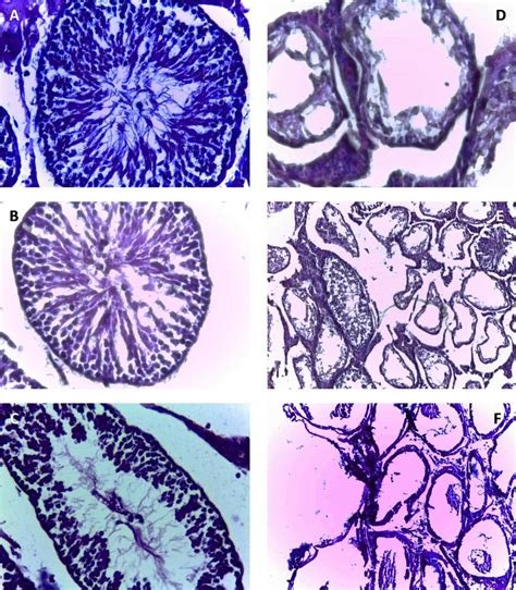 Sections From Rats Testicular Tissue A Controls Showing Seminiferous