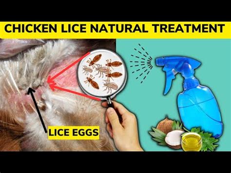 Eliminate Chicken Lice By Spraying This Organic Treatment Kills Lice