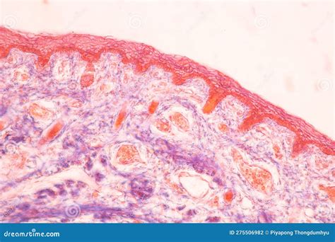 Histological Bone Elastic Cartilage Human And Joint Of Human Foetus Under The Microscope For