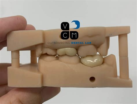 Digital Solutions Vcm Dental Lab