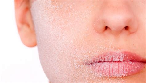 6 Cara Bibir Tetap Lembab Tanpa Filler Mudah Dan Praktis