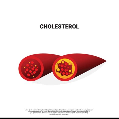 Coronary Artery Disease Is The Buildup Of Plaque In The Arteries That