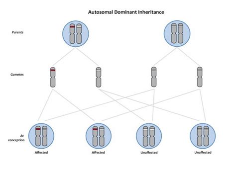 Achondroplasia: Definition And Genetic Conditions