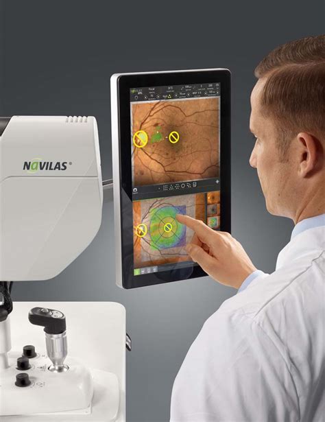 Navigated Laser Therapy With The Navilas Laser System S Eyetube