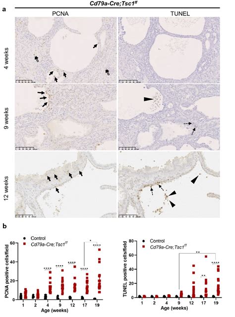 Proliferation And Apoptosis In Cd79a Tsc1 Knockout KO Kidneys A