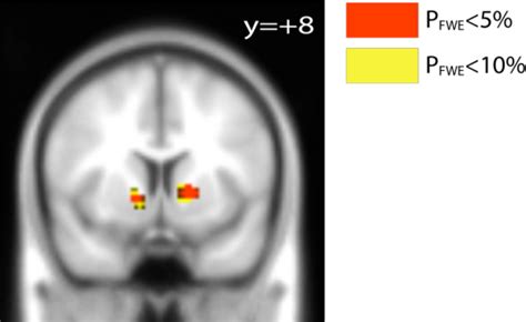 Figure S6 Group Level Map Of Functional Connectivity Using The Acc As Download Scientific