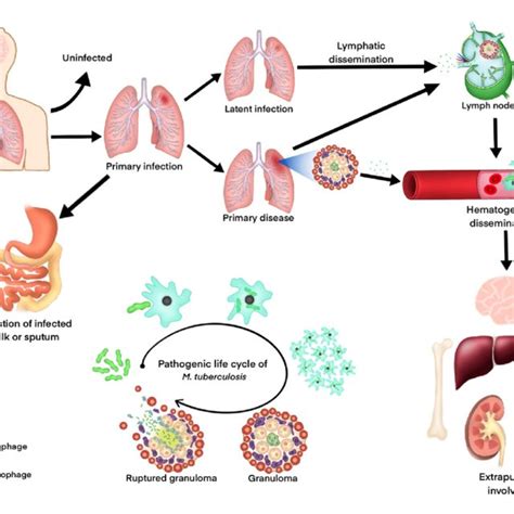 Pathogenic Life Cycle And Extrapulmonary Dissemination Of M