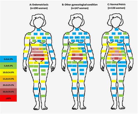 Pelvic pain may be common among reproductive-age women « Endometriosis.org